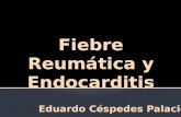 Fiebre Reumatica y Endocarditis Final