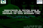 IMUNOEXPRESSÃO DA PROTEÍNA GSK3β EM TECIDOS DE CARCINOMA COLORRETAL HUMANO PREPARADOS POR TISSUE MICROARRAY (TMA) VII CICI – C ONGRESSO DE I NICIAÇÃO C.