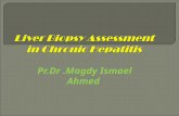 Dr magdy (liver biopsy)