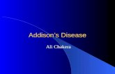 Addisonâ€™s Disease