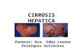 Cirrosis hepatica dra velasquez