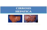 Cirrosis hepatica ok
