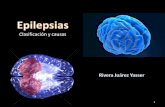 Epilepsias definición, clasificación y causas.