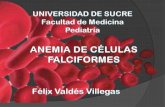 Anemia de células falciformes
