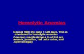 Hemolytic Anemias Normal RBC life span = 120 days. This is shortened in hemolytic anemias. Common manifestations to all HA are anemia, jaundice, red color.