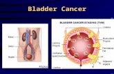 Bladder Cancer. Bladder cancer: Histology 90-95%transitional-cell carcinoma 3%squamos-cell carcinoma 2%adenocarcinoma