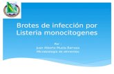 Brotes de infección por Listeria monocitogenes Por : Juan Alberto Muela Barraza Microbiología de alimentos.