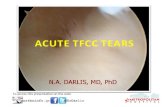 Οξείες Ρήξεις Τρίγωνου Χόνδρου- Acute TFCC Tears 2015