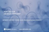 Western Blot Antibody Customer Review for β-actin Monoclonal Antibody (STJ96941)