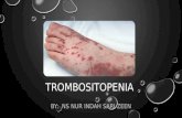 Askep Trombositopenia