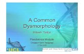 A Common Dysmorphology - University College Londonzchab6a/v3/clin2/DGH.pdf · A Common Dysmorphology Hitesh Tailor ... 1st Dec 2009. Turner’s Syndrome. Normal !! Down’s Syndrome.