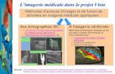 L’imagerie médicale dans le projet VistaL’imagerie ... · PDF fileEuropean Project Roboscope - Multi Modal Image Fusion Tools. ... e (I) F = h. i υ+