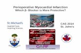 Perioperative Myocardial Myocardial... · PDF fileat reducing perioperative acute myocardial infarction. ... βBlockers Increase Perioperative Stroke? Bangalore Lancet 2008 β-Blockers