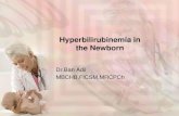 Hyperbilirubinemia in the Newborn - Al-Mustansiriya University10_54_57_AM.pdf · Dr.Ban Adil MBCHB,FICSM,MRCPCh . JAUNDICE (ICTERUS). • Def.:Yellow discoloration of the sclera,