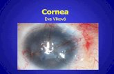Cornea - Masarykova univerzita · Ulcus corneae . Keratitis interstitialis •Interstitial keratitis - on the basis of the immune response to live microbe - antigen in the cornea