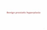 Benign prostatic hyperplasia - Suli Pharma•Benign prostatic hyperplasia (BPH) is the most common benign tumor in men and is responsible for urinary symptoms in the majority of males