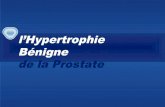 l’Hypertrophie Bénigne de la Prostate...• Les α-bloquants : Ils inhibent la contraction musculaire lisse de la prostate, ils n’agissent pas sur le processus de prolifération