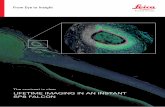 The contrast is clear LIFETIME IMAGING IN AN INSTANT SP8 ... · – Prof. Enrico Gratton, UCI Samueli, University of California, Irvine “The Leica SP8 FALCON is the first commercial
