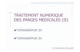 TRAITEMENT NUMERIQUE DES IMAGES TOMOGRAPHIE 2D TOMOGRAPHIE 3D D. Mariano-Goulart Tomographie 2D et 3D