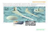 Schnelleres Einheilen durch die elektrochemische ... interface: improving biomaterials and tissue reactions