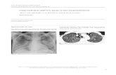CASO CLÍNICO ARP Nº6: QUAL O SEU DIAGNÓSTICO? 106 ccARPn6.pdf · 2020. 1. 8. · Figura 2 – Imagem axial de TC torácico, janela pulmonar. Figura 1 – Radiografia de tórax,