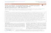 Post-mortem histopathology underlying خ²-amyloid PET ... A recent phase III trial of [18F]flutemetamol