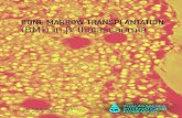 BONE MARROW TRANSPLANTATION (BMT) in β-thalassaemia...TAAAMA TRATA FRAT - 6- - 7-Bonemarrow transplantation (BMT) is to date the only well-established curative treatment forthalassaemia