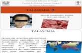 TALASEMIA β (hemato)