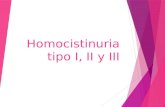 Homocistinuria tipo i, ii y iii
