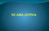 CURS 4 1Scarlatina